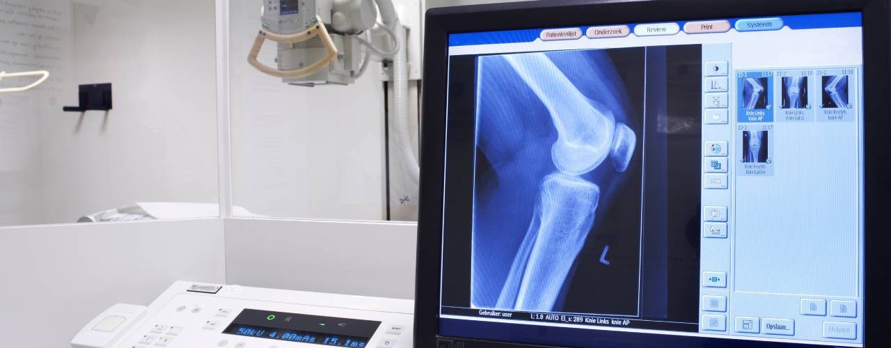 A computer with an X-ray of a knee. Behind the computer desk and a glass wall is a radiography machine.